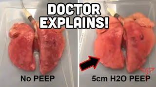 P.E.E.P. in 90 seconds - DOCTOR Explains