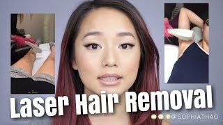 Laser Hair Removal Experience | Sophia Thao