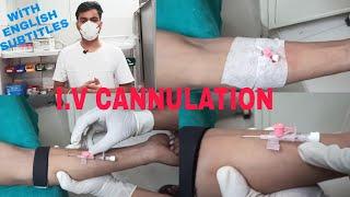 Intravenous Cannulation Technique | Iv Cannulation Procedure