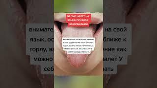 белый налёт на языке признак заболевания #народнаямедицина #народныерецепты