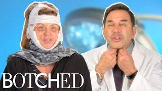 Dr. Nassif Fixes Lisa’s Facelift Gone Wrong FULL TRANSFORMATION | Botched | E!