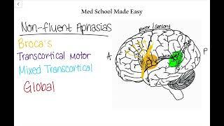 Non-Fluent Aphasias Made Easy: How to Distinguish and Remember Them!