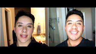 6 Months on Testosterone -  Voice Change #2023 #testosterone #ftm