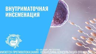 Внутриматочная (искусственная) инсеминация