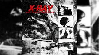 [200+] FREE UK DRILL DRUM KIT 2023 + SAMPLE PACK "X-RAY" | FREE DRUM KIT 2023