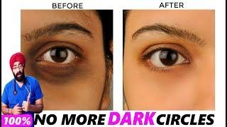 SCIENCE OF DARK CIRCLES : Reason to Remedy | Explained in ENG | Dr.Education