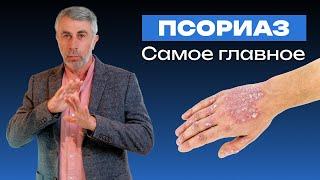 ПСОРИАЗ. Самое главное