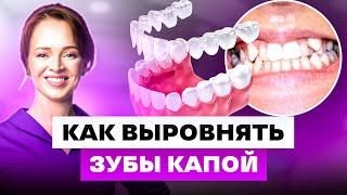 КАК ВЫРОВНЯТЬ ЗУБЫ БЕЗ БРЕКЕТОВ?