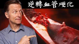 血管硬化原因？修復血管硬化的營養素！自然療法,柏格醫生 Dr Berg