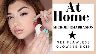 AT HOME MICRODERMABRASION TREATMENT - Get Flawless Glowing Skin | Chloe Zadori