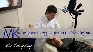Контурная коррекция лица Ч.2 Скуловая область Dr.Valeriy Potiy
