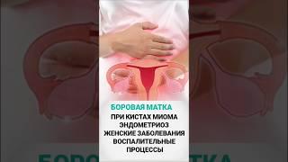 Боровая матка от многих женских заболеваний ‼️ Сибирское Здоровье #siberianwellness #киста #миома