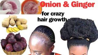 HAIRLOSS ISSUES?  Use Onion and Ginger and Grow Your Hair Like Crazy. 100% Guaranteed Result