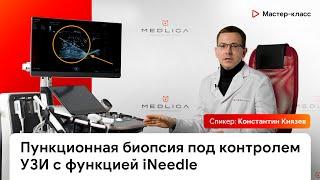 Пункционная биопсия под контролем УЗИ с функцией iNeedle