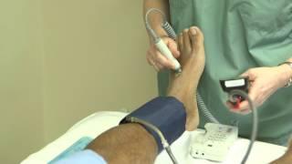 How to perform an ankle brachial index