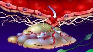 Introduction to Cancer Biology (Part 4): Angiogenesis