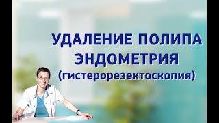 Удаление полипа эндометрия (гистерорезектоскопия).