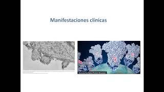 Consenso Colombiano de atención, diagnóstico y manejo de la infección por SARS -COV-2