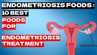 Endometriosis | Endometriosis Treatment | 10 Best Foods For Endometriosis