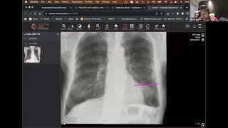 Review Cases together with us #part7