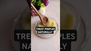 How to treat pimple naturally. #pimpletreatment #skincare #naturalskincare #skincaretips