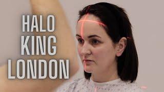 Hairline Lowering Surgery | Dr. Greg Bran