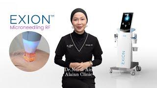 Microneedling RF With BTL Exion.