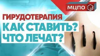 Гирудотерапия | Лечение пиявками. Как ставить пиявки?