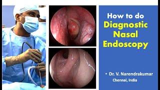 How to do Diagnostic Nasal Endoscopy- Dr. V. Narendrakumar