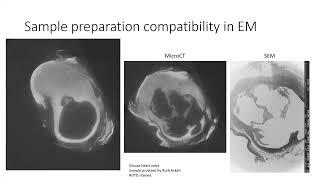 Using microCT in Conjunction with Electron Microscopy