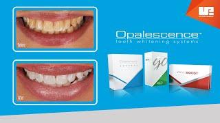 Professional Results with Opalescence™ teeth whitening