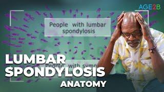 Lumbar Spondylosis, Spondylolysis, & Spondylolisthesis (Lumbar Spine) How is Spondylosis treated?