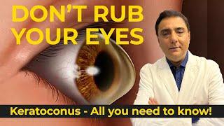 All you need to know about Keratoconus!