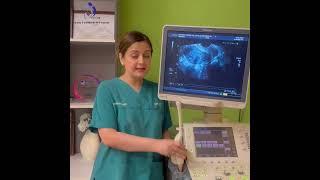 PCOS Series Part 1