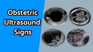 Obstetric Ultrasound Signs