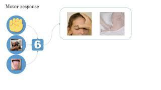 How to Asses GCS | Glasgow coma scale - redmedbd