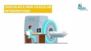 Dr Suresh Giragani | Apollo Hospitals Hyderabad