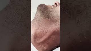 Neck Waxing | Men's Neck Waxing | Smooth Neck