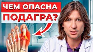 Как БЫСТРО избавиться от БОЛИ в большом пальце ноги!? / Профилактика ПОДАГРЫ в домашних условиях