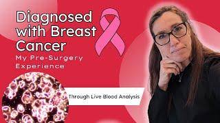 My Breast Cancer Journey Through Live Blood Analysis🩸