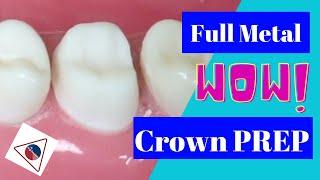 Crown Preparation in Three Steps (Tutorial) | In Office to Hands On Dental Training