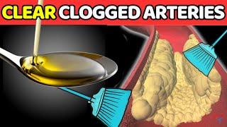 Top 7 SIMPLE DELICIOUS Foods To CLEAR Clogged Arteries (PART 2).