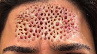 Top Trypophobia SFX of All Time!  Best Trypophobia Makeup & Special Effects