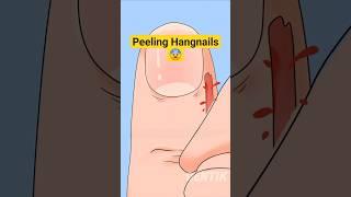 Peeling the WORST Hangnail Ever #satisfying #shorts #funnyanimation