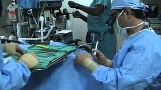 Adult Tonsillectomy Surgery | Beverly Hills Head & Neck Surgeon