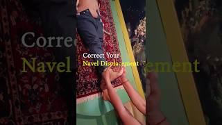 How to Correct Your Navel Displacement