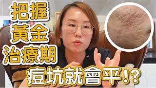 臉上的痘疤要怎麼治療才可以消失？今天跟你說早期痘疤治療的重要性！