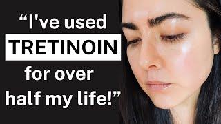 My 22-YEAR Tretinoin Experience: The Key to Youthful Skin for Over 2 Decades