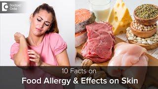 Food Allergy & how it affects SKIN | Causes, Symptoms & Treatment-Dr.Rajdeep Mysore |Doctors' Circle