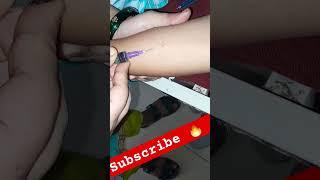 Sensitive skin checkup technique#shorts#sensitivity#skincare#technique#youtubeshorts#shortsfeed